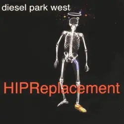 Hip Replacement Hip Replacement