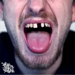 Drugs, Booze & Dental Issues