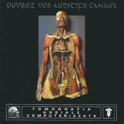 Ouvrez vos auditifs canaux