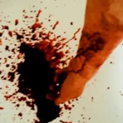 Monarchy of Terror on the Broken Mind by Voorh's Disease