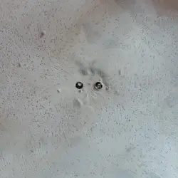 Artificial Heart