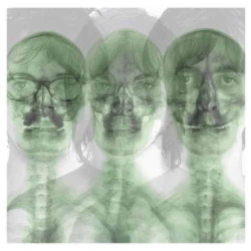 Supergrass