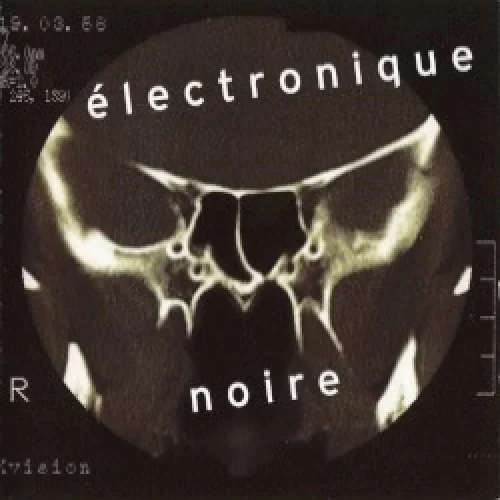 Électronique noire